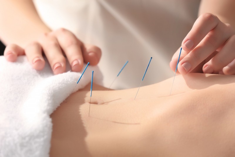 acupuntura para engravidar pode fazer bem mais que reduzir estresse